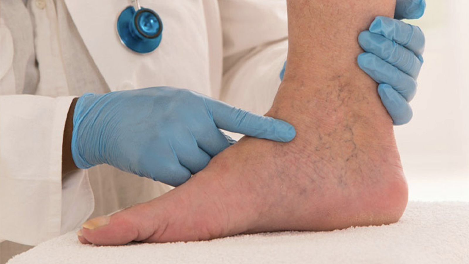 bacakta sislik ve agri hissedenler dikkat derin ven trombozunun isaretcisi olabilir UbcOBvd3